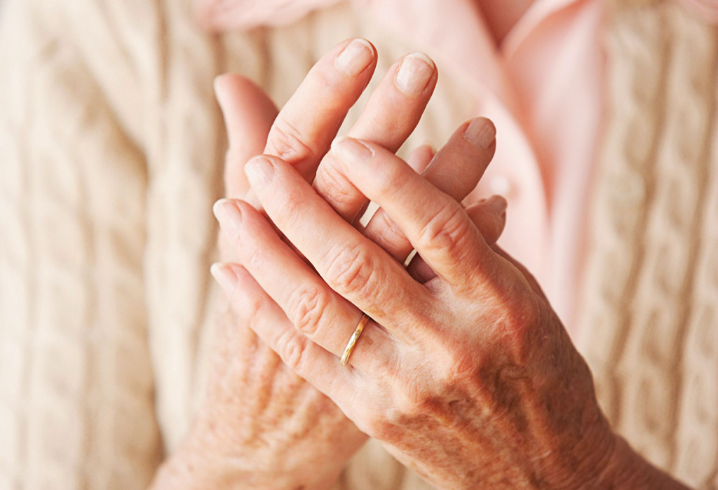 5 mitos sobre la Artritis Reumatoide