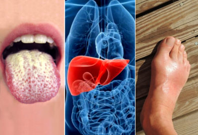 5 señales de advertencia de que tu hígado está lleno de toxinas.